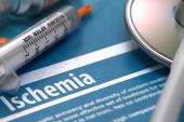 ischemia